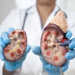 Role of Hydration in Maintaining Proper Kidney Care Functions Naturally